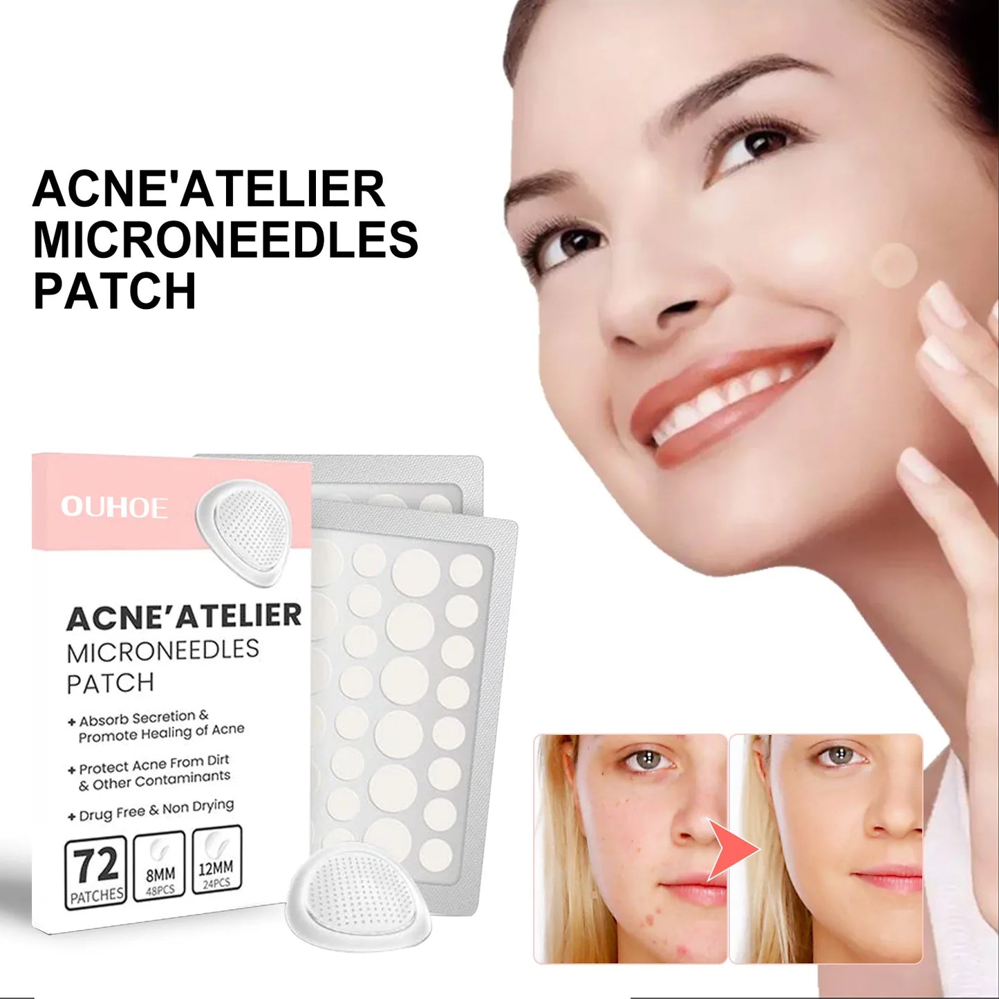 Face Patches for Pimples Microneedles Drying Patch Blemish Covering Stickers 72 Count Invisible Spot Care Absorbing All Day